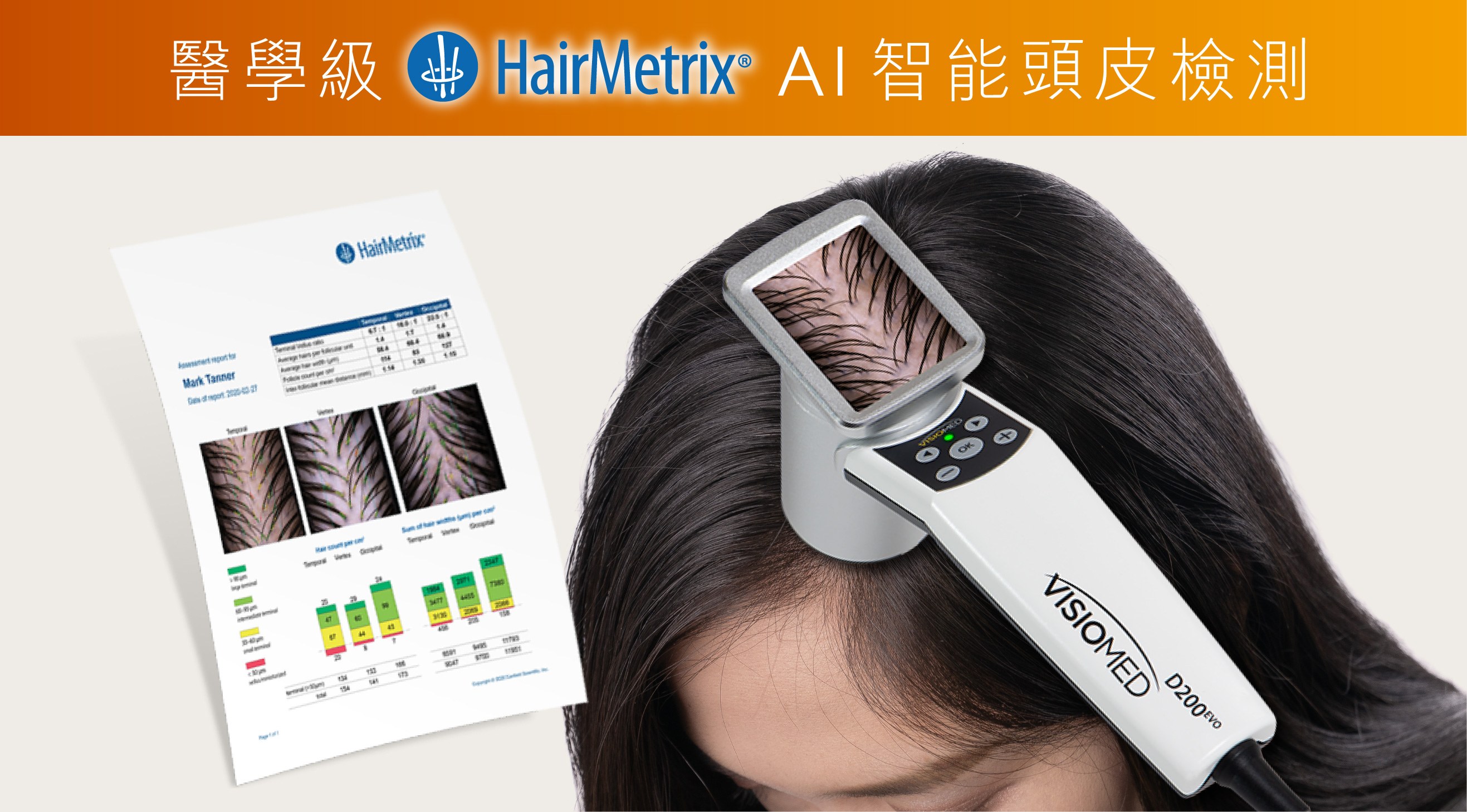 +medispa 醫學級 HairMetrix AI智能頭皮檢測